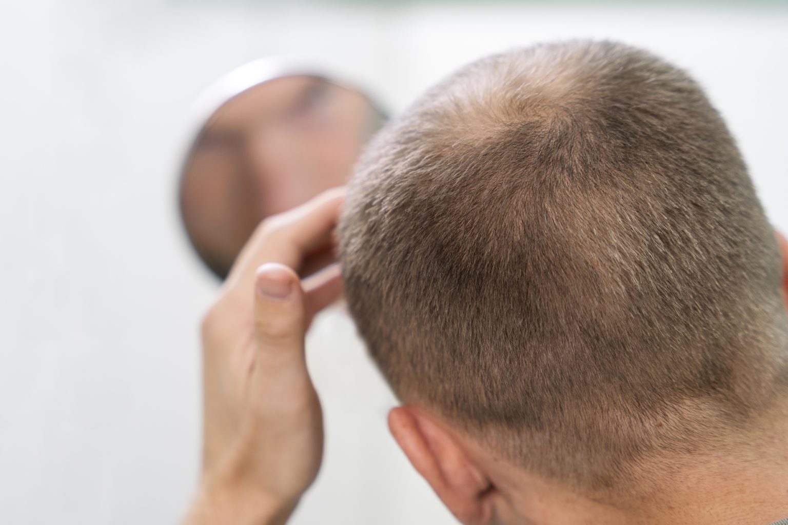 Hair Loss And Photobiomodulation